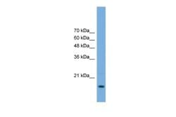 RPP20 Rabbit anti-Human, Polyclonal, Novus Biologicals 0.1ml; Unconjugated:Antibodies,